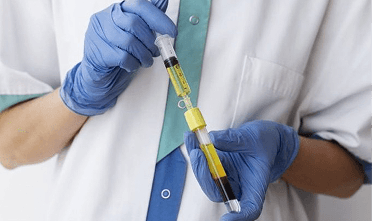 Platelet-rich plasma laboratory preparation